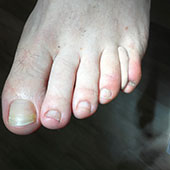 Orthoplastie